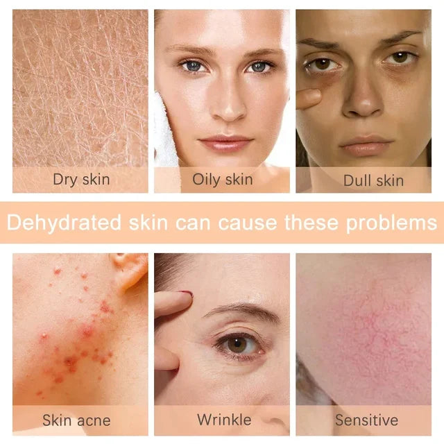 Hot Mist Ionic Facial Steamer - Home Sauna Humidifier & Moisturizer